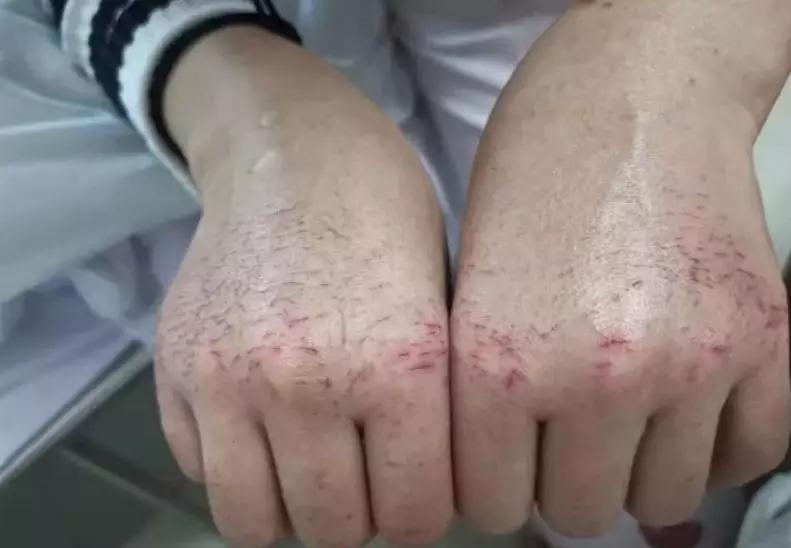 新肺炎病毒最新动态更新，病毒状况实时关注